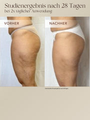 Body Contour Cream