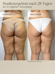 Body Contour Cream