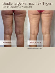 Body Contour Cream