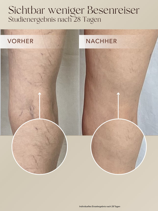 Body Contour Cream